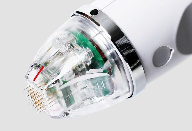 Microagulhamento por radiofrequência (RF)