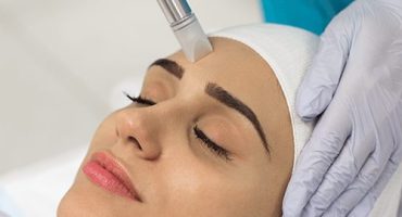 Microagulhamento com Meso-Pen incluindo tratamento de peeling ácido básico