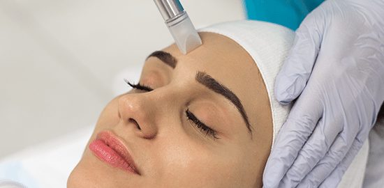 Microagulhamento com Meso-Pen incluindo tratamento de peeling ácido básico