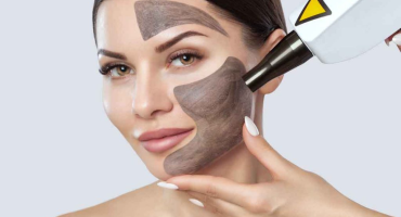 Laser de Peeling de Carbono Nd:YAG