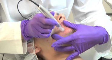 Microagulhamento com Caneta Meso