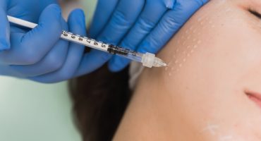 Mesoterapia (mão livre)