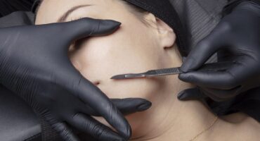 Dermaplaning